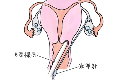 http://fuzhou.vdtfzz.com/post/205.html|福州供卵助孕
