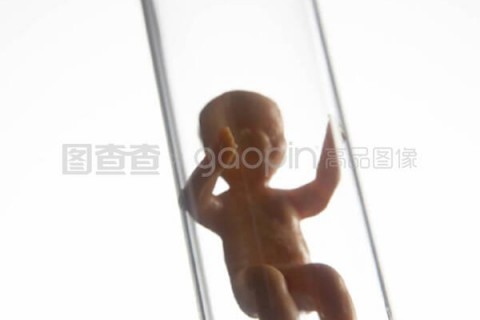 http://fuzhou.vdtfzz.com/post/197.html|福州试管助孕